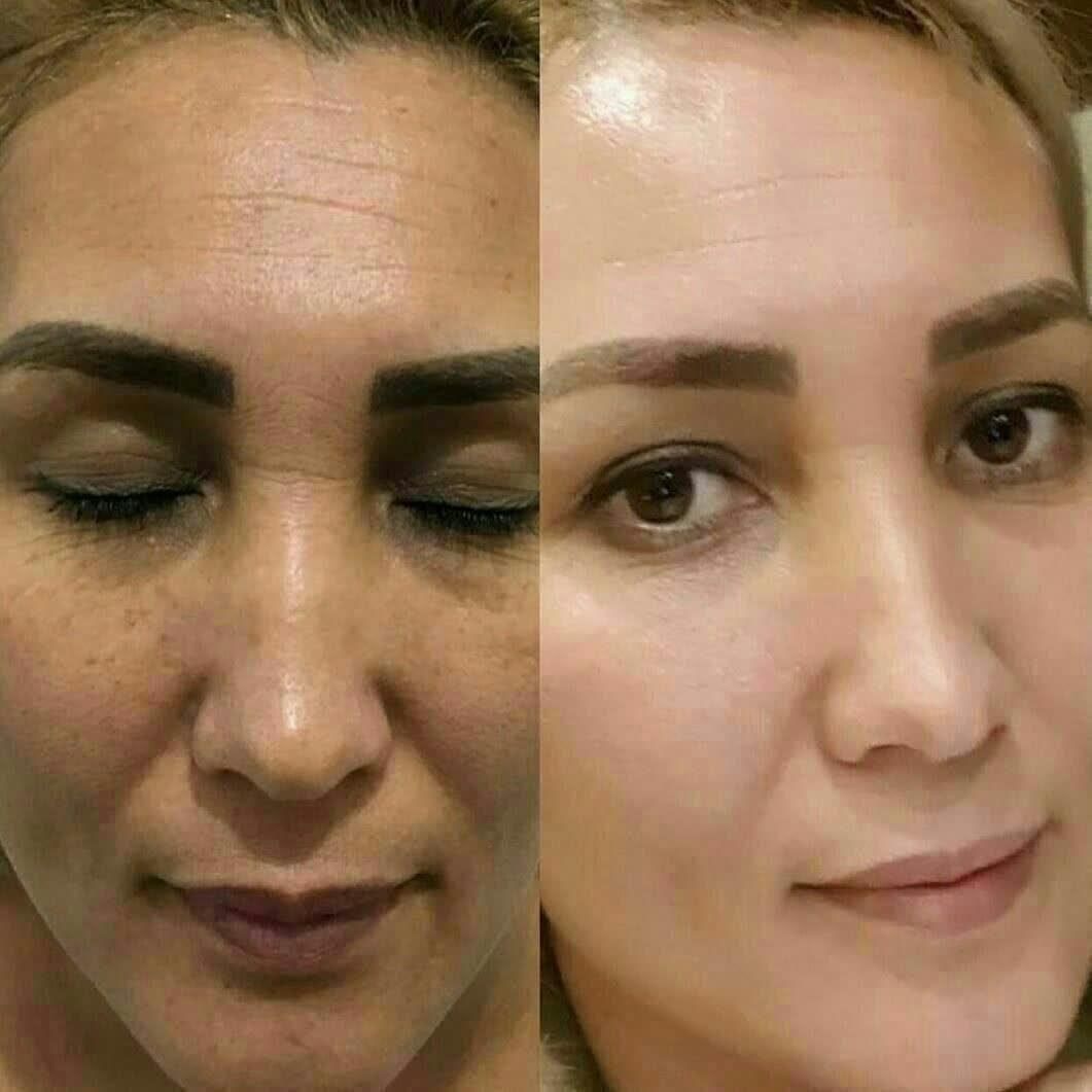 برای موفقیتهای. بانوان سرزمینم|فعالیت داوطلبانه|رشت, پیرکلاچای|دیوار