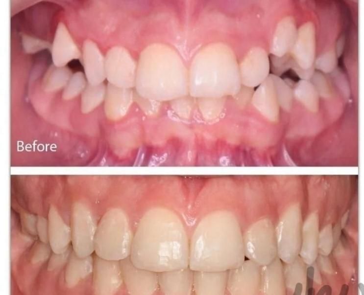 ارتودنسی اقساط بدون پیش پرداخت|خدمات آرایشگری و زیبایی|مشهد, شهرک رازی (شهرک غرب)|دیوار