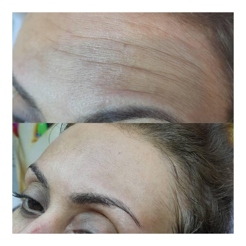 خدمات وآموزش پاکسازی پوست فیشیال فقط ویژه بانوان|خدمات آرایشگری و زیبایی|مشهد, طلاب|دیوار