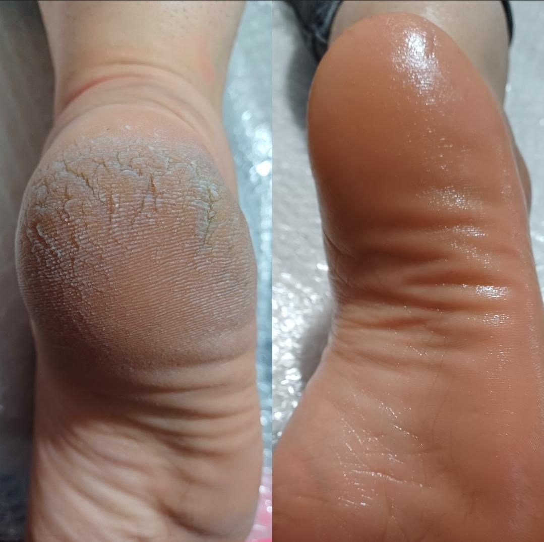 پاکسازی پوست|خدمات آرایشگری و زیبایی|بروجرد, |دیوار