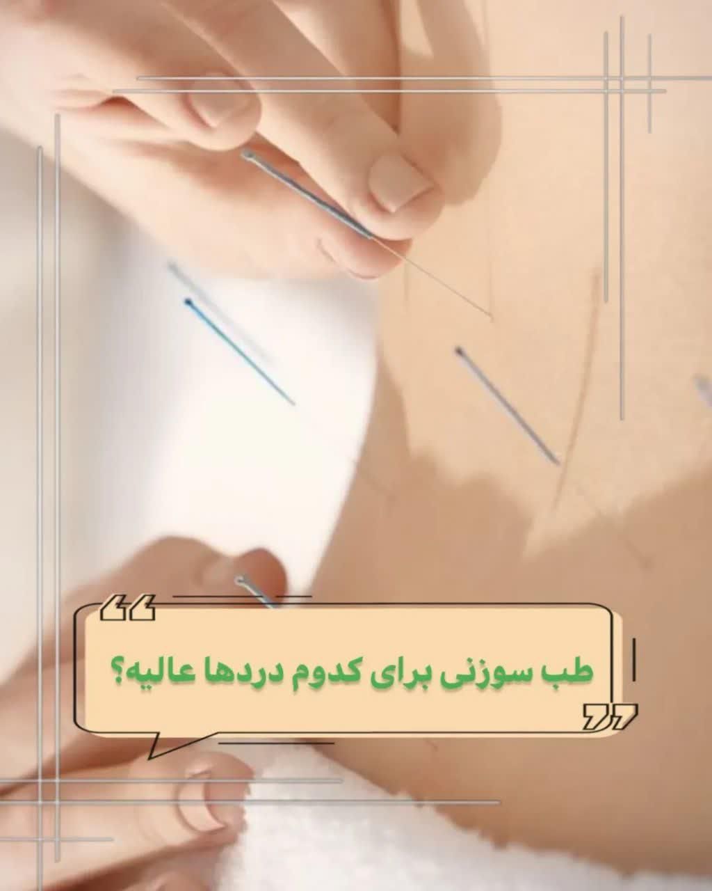 حجامت بادکش زالو طب سوزنی فصد خون امبدینگ|خدمات آرایشگری و زیبایی|اصفهان, ملک‌شهر|دیوار