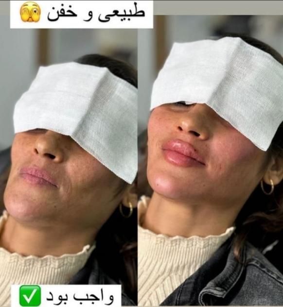 خدمات تخصصی ژل و بوتاکس|خدمات آرایشگری و زیبایی|شاهین‌شهر, فردوسی|دیوار