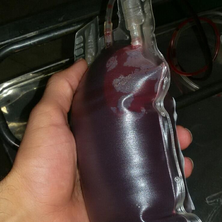 بخیه و تزریقات سرم تراپی و پانسمان در منزل|خدمات آرایشگری و زیبایی|خرم‌آباد, |دیوار