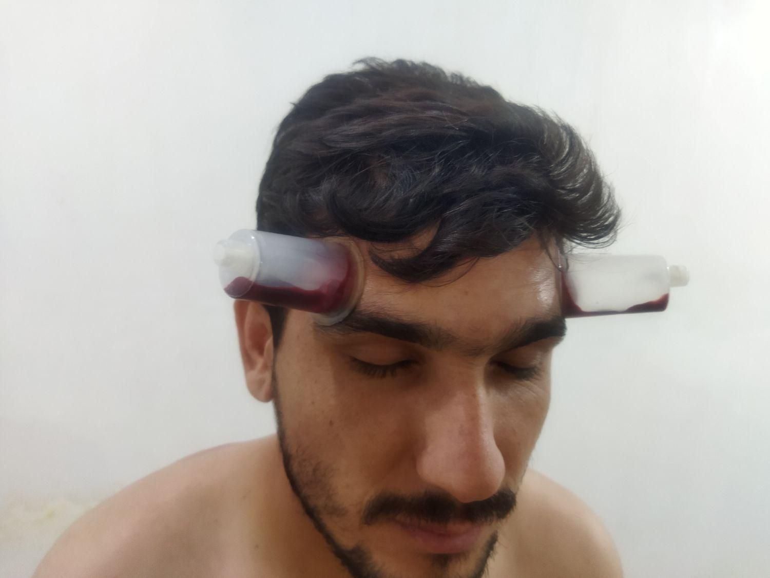 طب سنتی زالو درمانی و حجامت|خدمات آرایشگری و زیبایی|اهواز, گلستان|دیوار
