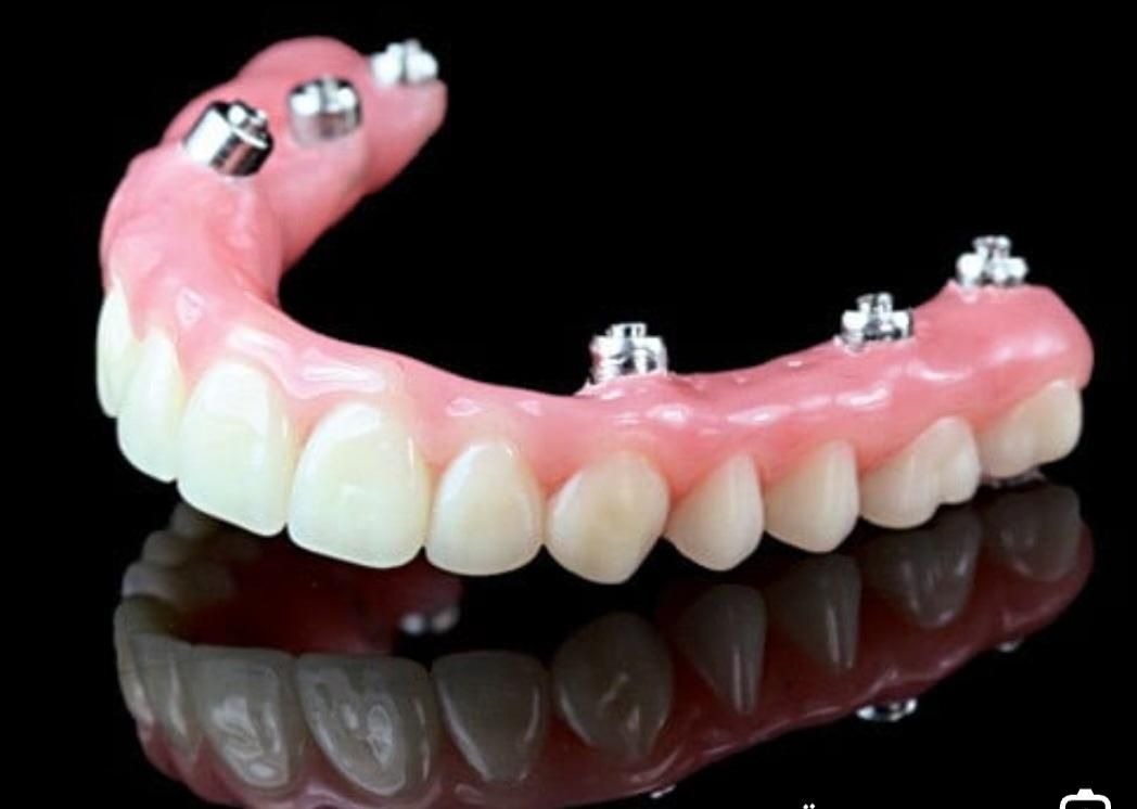 پروتز دندان مصنوعی( آقای عماد)|خدمات آرایشگری و زیبایی|سیرجان, |دیوار