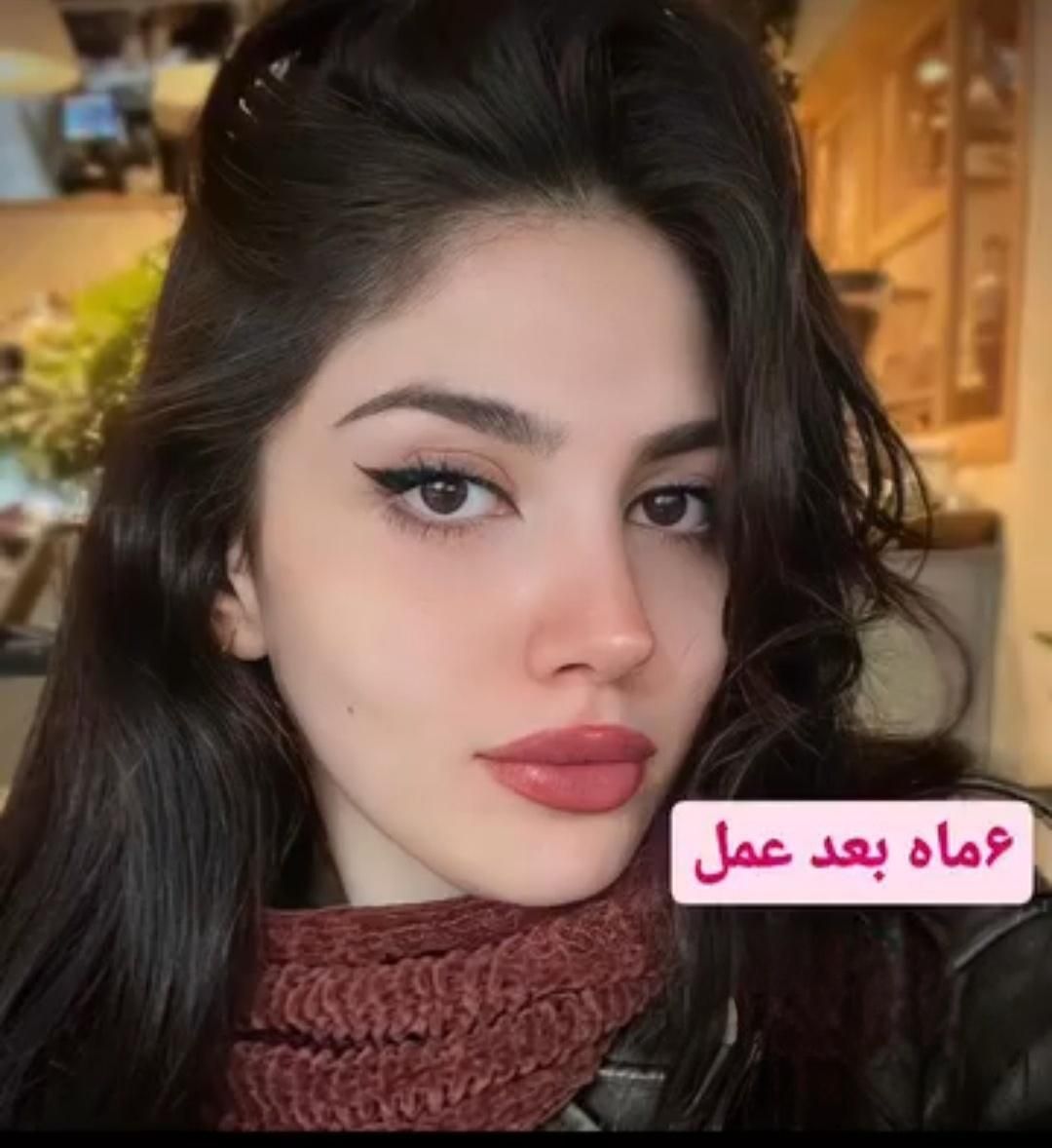 عمل جراحی بینی بامتخصص گوش،حلق،بینی|خدمات آرایشگری و زیبایی|تهران, ونک|دیوار