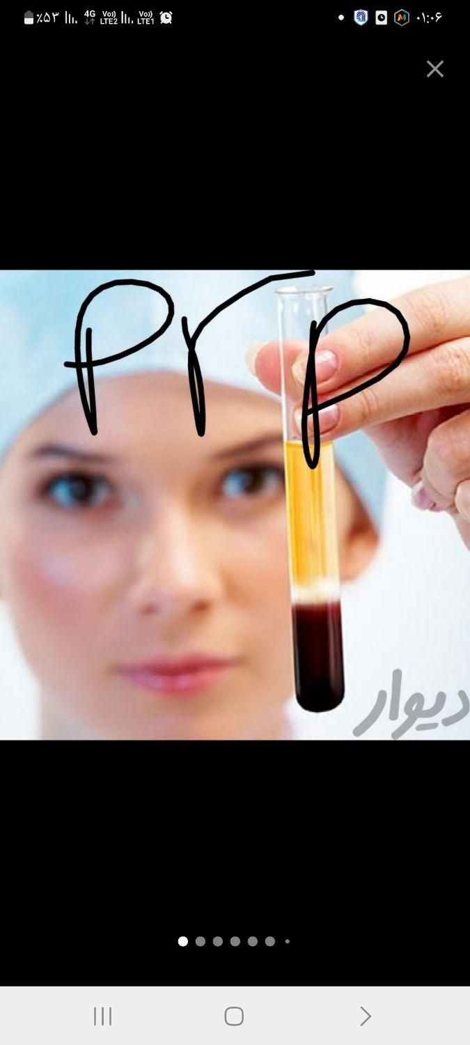 خال برداری ،پی آرپی،|خدمات آرایشگری و زیبایی|مشهد, موسوی قوچانی|دیوار