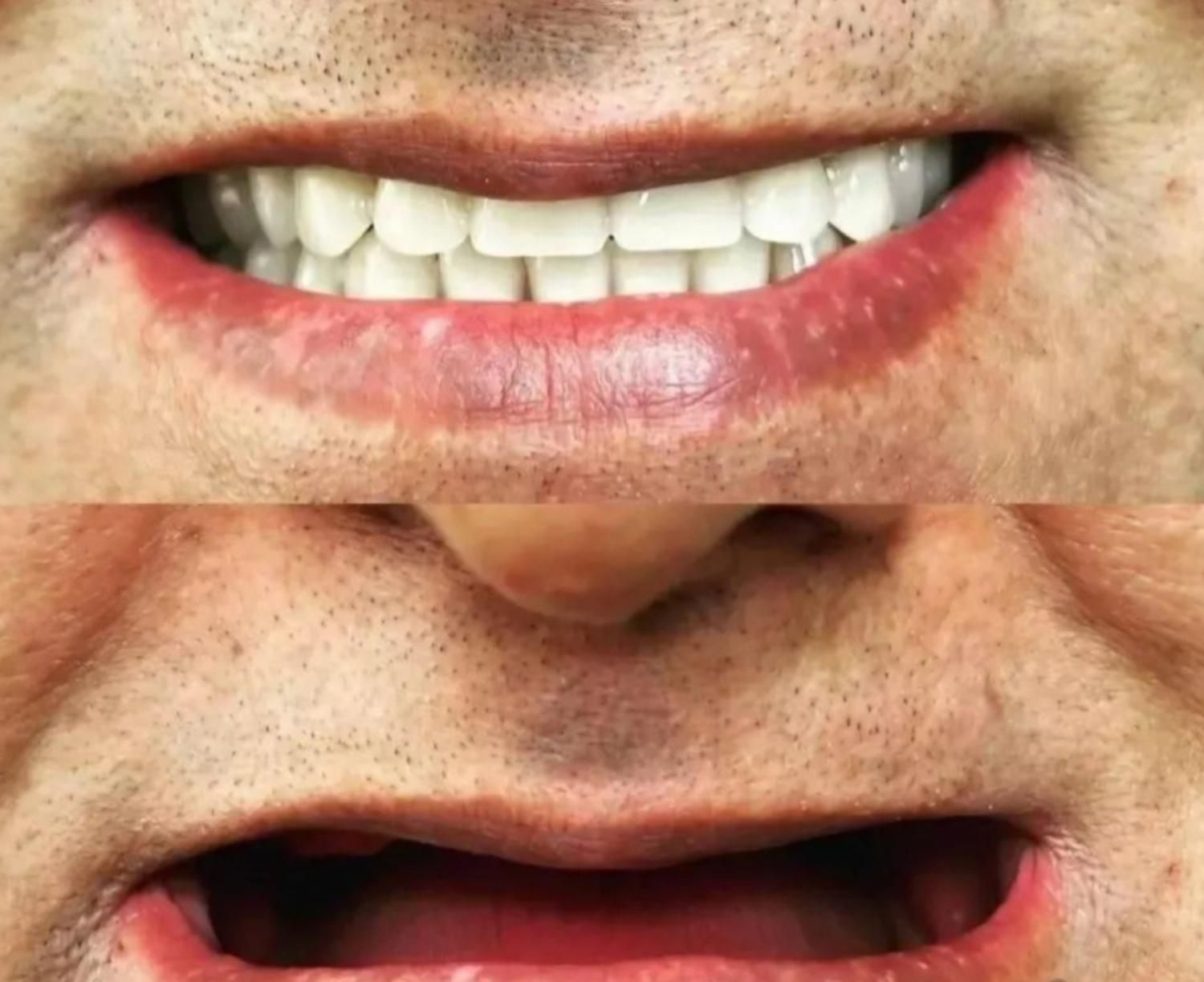 دندانسازی مرکزی ساخت انواع دندان مصنوعی|خدمات آرایشگری و زیبایی|یزد, |دیوار