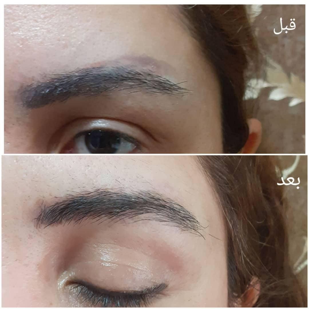 پاک کردن تتو ابرو و خط چشم/با لیزر|خدمات آرایشگری و زیبایی|تهران, پونک|دیوار