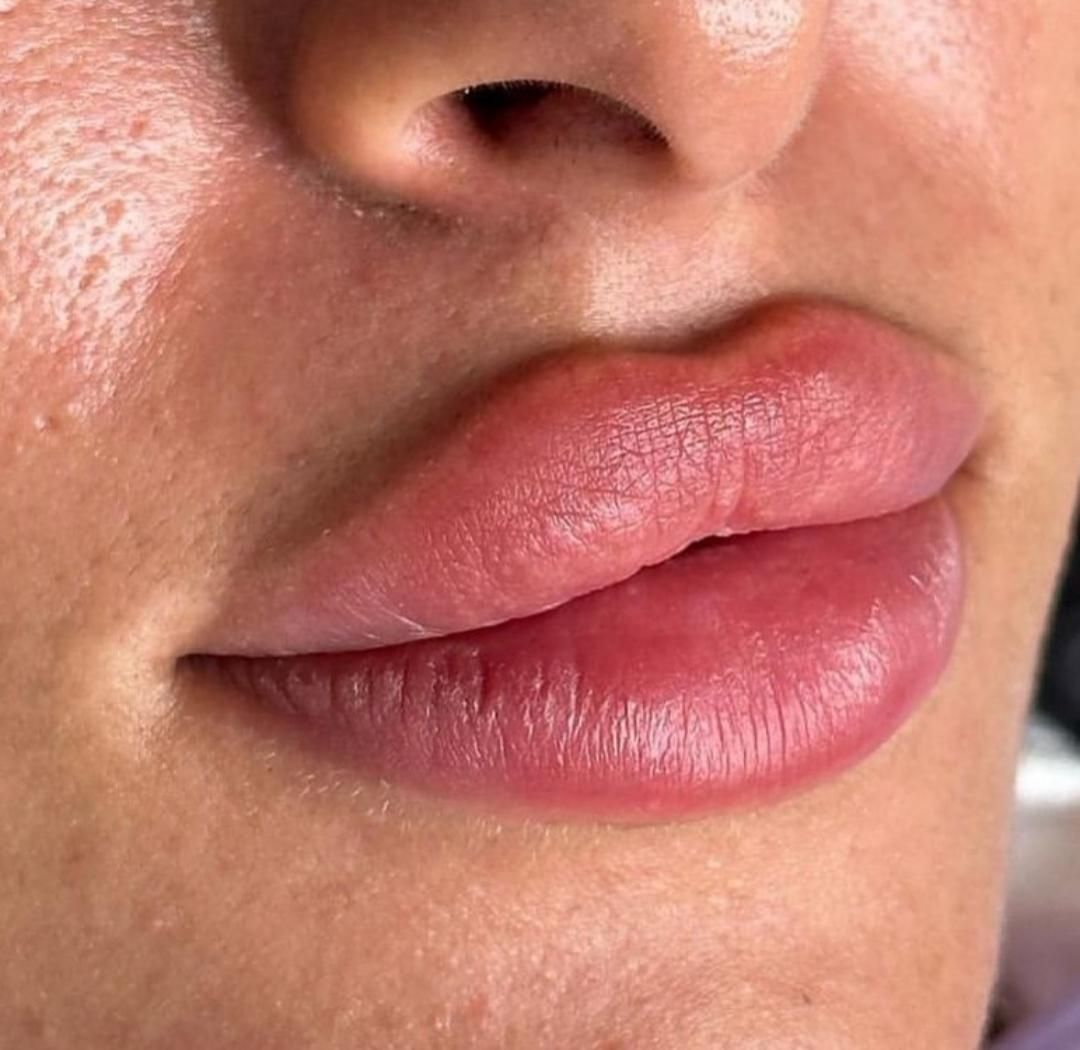 تزریق ژل وبوتاکس،نخ کاگ یالیفت صورت،اموزش|خدمات آرایشگری و زیبایی|تهران, شهرک شریعتی|دیوار