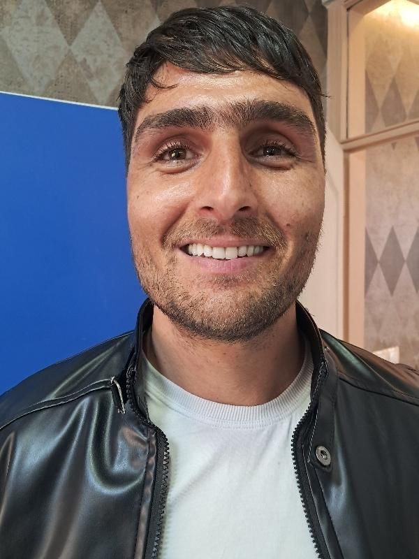 دست دندان مصنوعی طرح لمینت زیبایی تا ۶ ماه اقساط|خدمات آرایشگری و زیبایی|تبریز, |دیوار