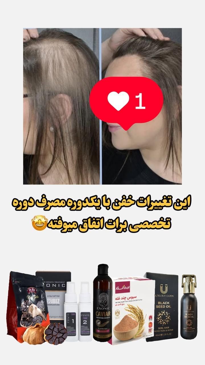 قطع ریزش مو و رویش مجدد مو|آرایشی، بهداشتی، درمانی|تهران, حسین‌آباد|دیوار