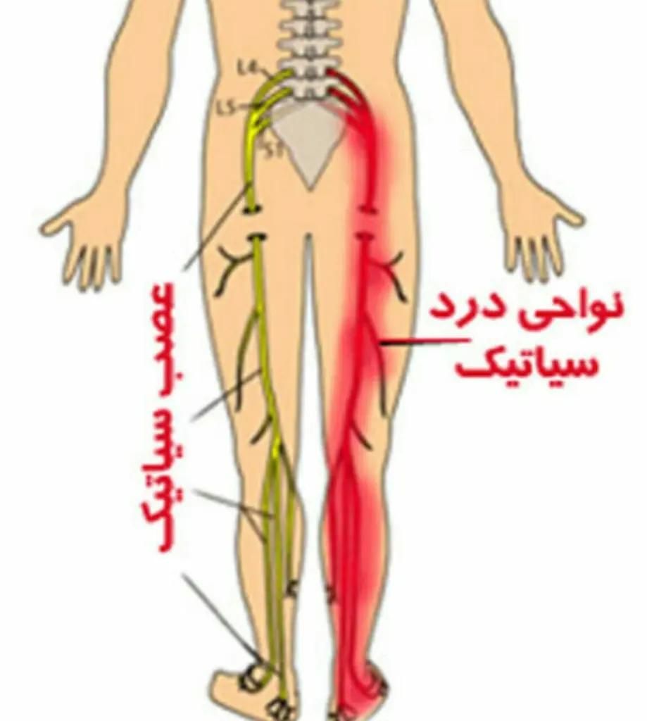 حجامت،فصد،زالودرمانی، زیر نظر پزشک|خدمات آرایشگری و زیبایی|اصفهان, شهرک زاینده رود|دیوار