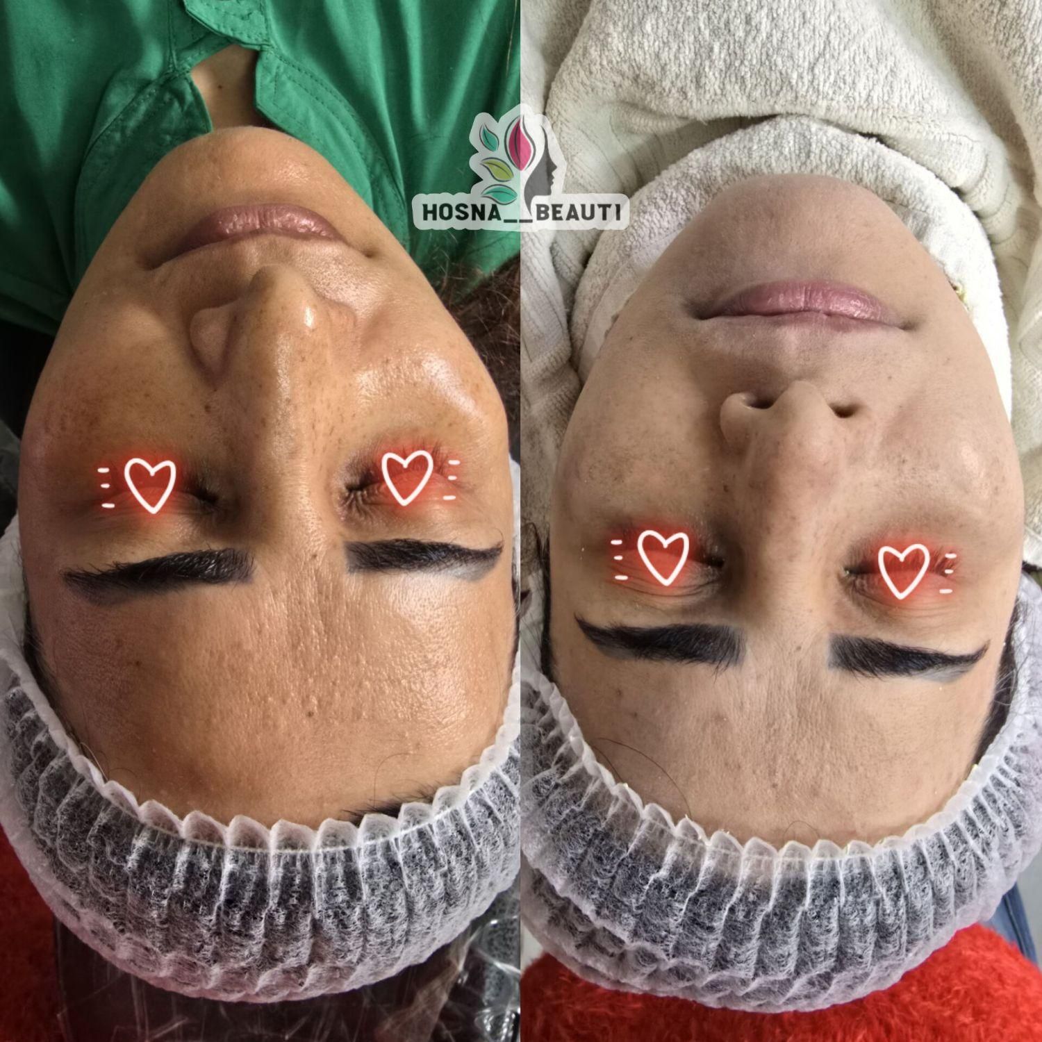 مدل پاکسازی پوست . لیفت و لمینت . کراتین میکاپ|خدمات آرایشگری و زیبایی|مشهد, طبرسی شمالی|دیوار
