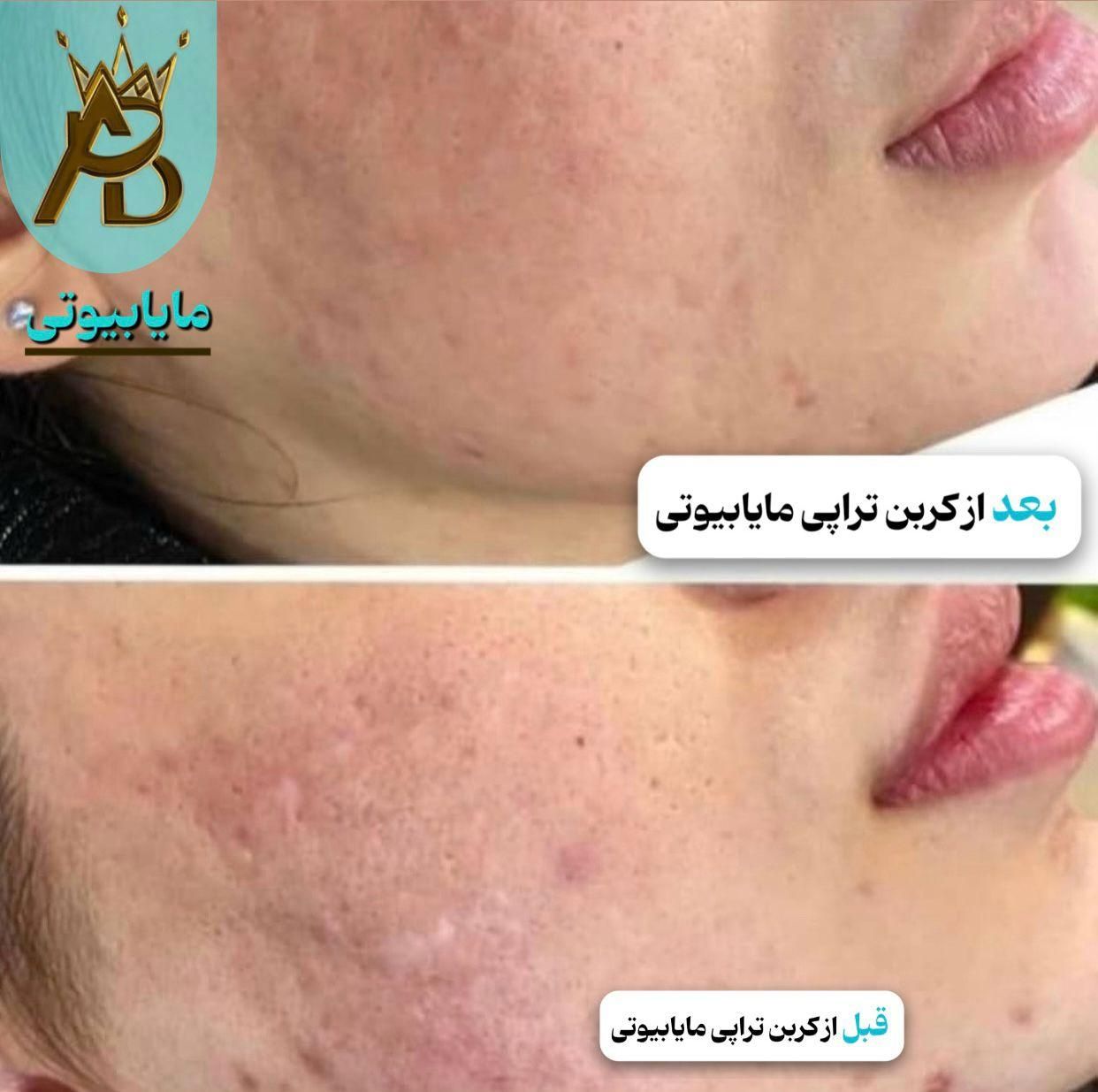 اولین مرکز روشن کننده بیکینی و زیربغل،مایابیوتی|خدمات آرایشگری و زیبایی|یاسوج, |دیوار
