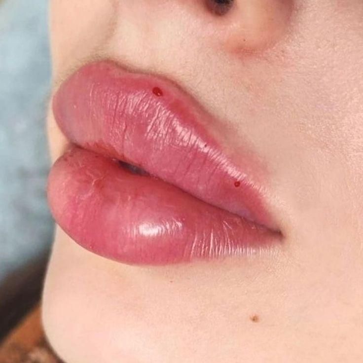 مادلینگ صورت،بوتاکس،لب روسی بانوان و آقایان|خدمات آرایشگری و زیبایی|تهران, توحید|دیوار