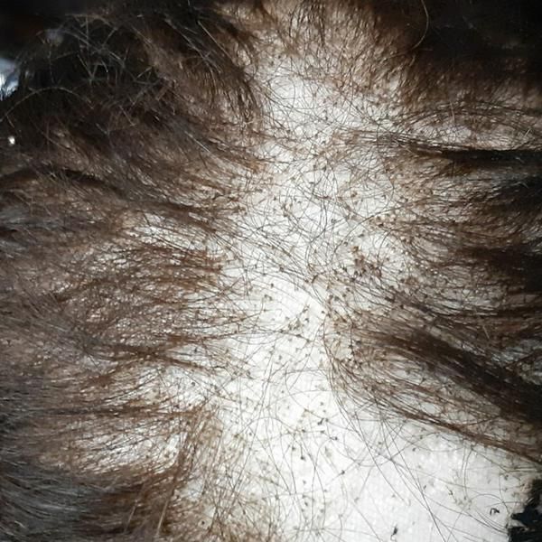 تعمیرات تخصصی پروتز مو ترمیم پروتزمو|خدمات آرایشگری و زیبایی|تهران, کوی فردوس|دیوار