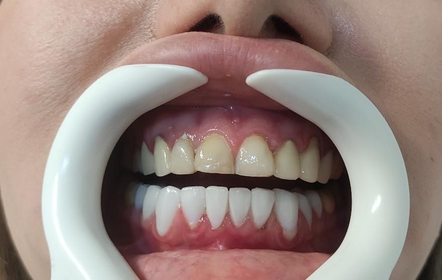کلینیک تخصصی دندانپزشکی امین|خدمات آرایشگری و زیبایی|مشهد, چهارچشمه|دیوار