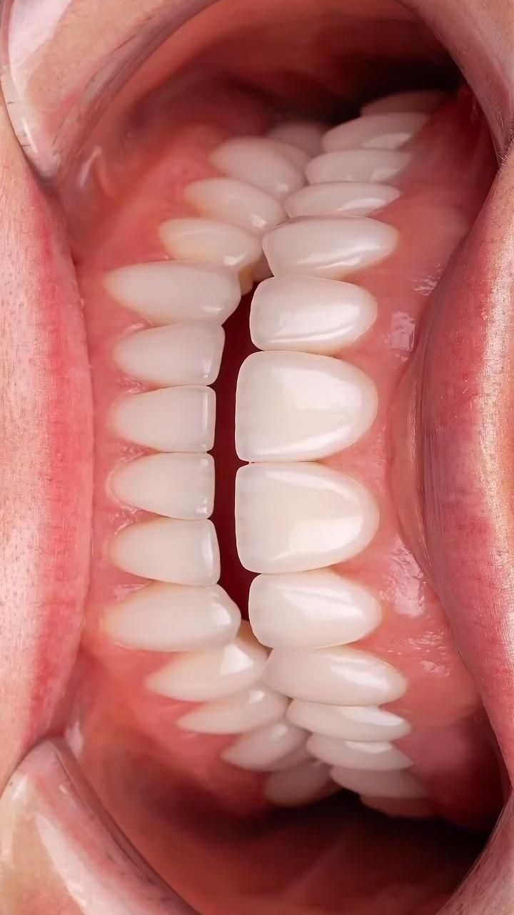 کامپوزیت دندان|خدمات آرایشگری و زیبایی|پاکدشت, خاتون آباد|دیوار