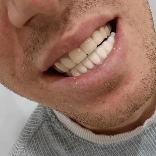 خدمات دندانسازی و دندانپزشکی|خدمات آرایشگری و زیبایی|ارومیه, |دیوار