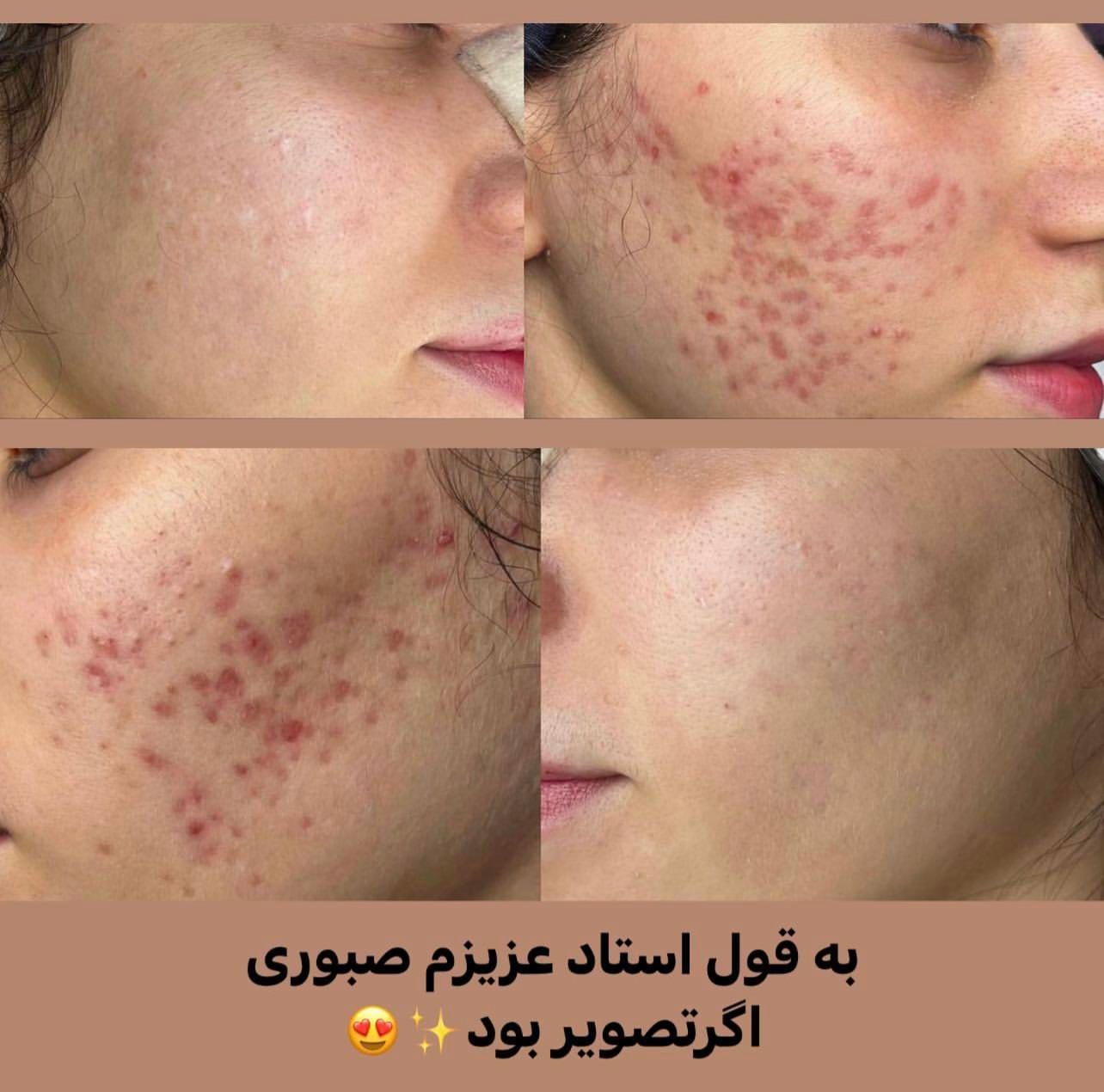 فیشال و خدمات تخصصی پوست توسط پیراپزشک در مطب پزشک|خدمات آرایشگری و زیبایی|مشهد, سجاد شهر|دیوار