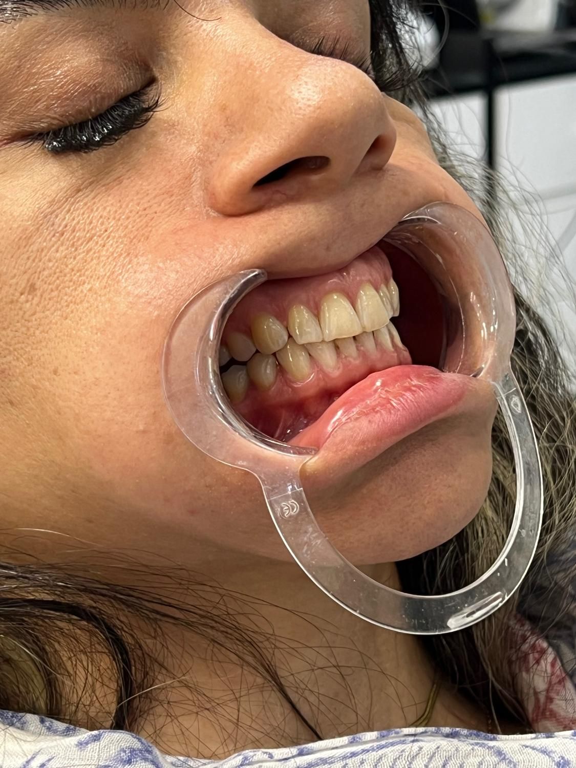 دندان پزشکی تخصصی و اقساطی|خدمات آرایشگری و زیبایی|تهران, چهارصد دستگاه|دیوار