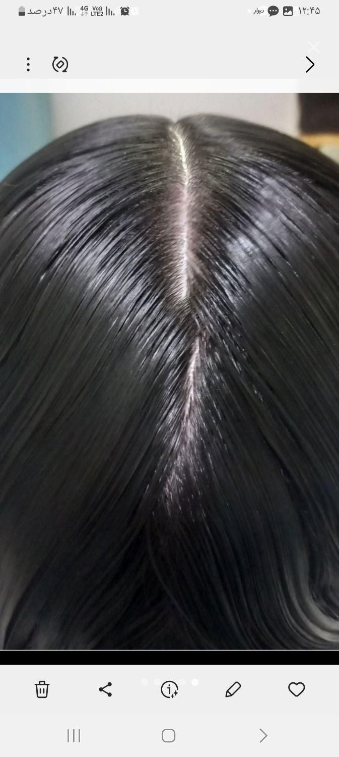 محلول پاکسازی شپش ورشک در سالن پاکسازی مو|آرایشی، بهداشتی، درمانی|قم, نیروگاه|دیوار