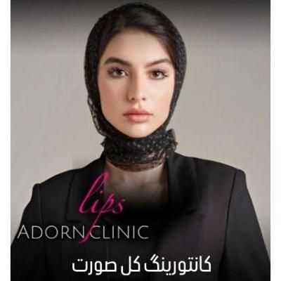 مدل فیلر لب روسی،کانتورینگ صورت،زاویه،چانه وشقیقه|خدمات آرایشگری و زیبایی|تهران, صادقیه|دیوار