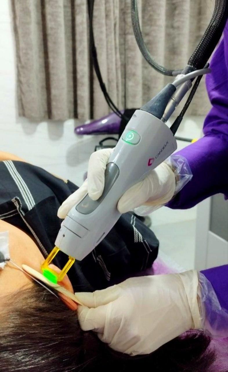 لیزر موی زائد الکس کندلا آمریکایی 2022 (شوش)|خدمات آرایشگری و زیبایی|شوش, |دیوار