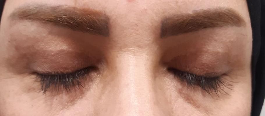 (شوش، شوشتر، اندیمشک) بلفاروپلاستی|خدمات آرایشگری و زیبایی|شوش, |دیوار