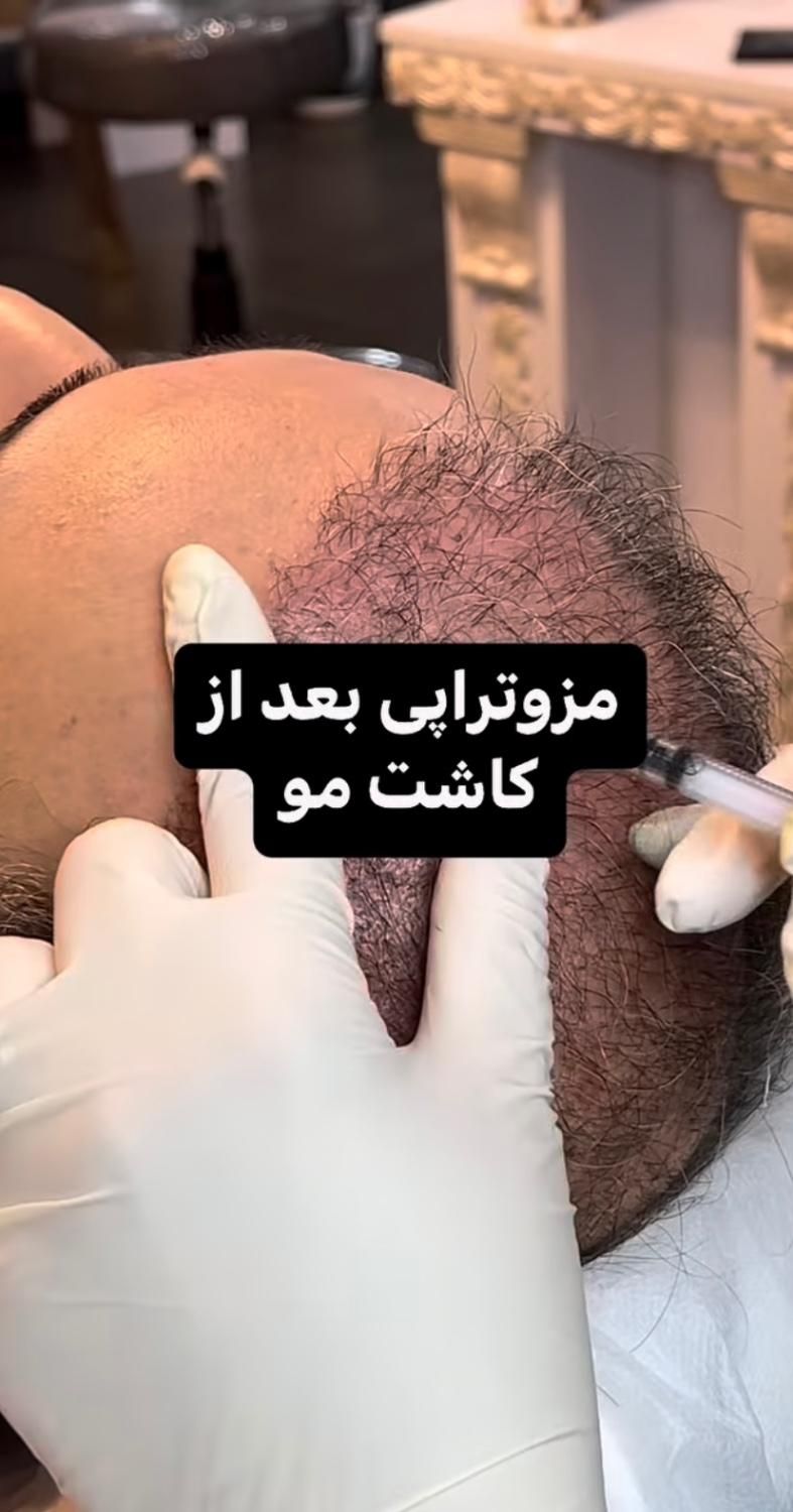 پی آر پی|خدمات آرایشگری و زیبایی|رشت, کاکتوس|دیوار