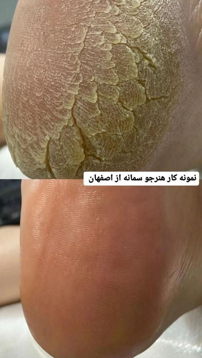 اموزش پدیکور و کفسابی+ مدرک بین الملی معتبر|خدمات آرایشگری و زیبایی|اصفهان, شاهزید|دیوار