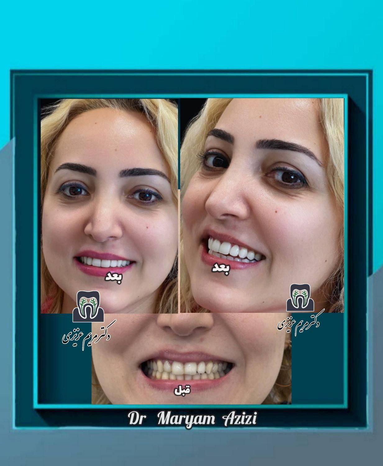 خدمات ترمیم دندان ،مطمین ترین تکنیک های دندانپزشکی|خدمات آرایشگری و زیبایی|شیراز, معالی‌آباد|دیوار