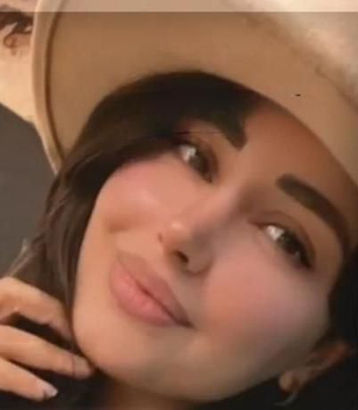 عمل بینی لیزری/پیزوسرجی/انواع بینی/قسطی بدون سود|خدمات آرایشگری و زیبایی|شیراز, قصرالدشت|دیوار