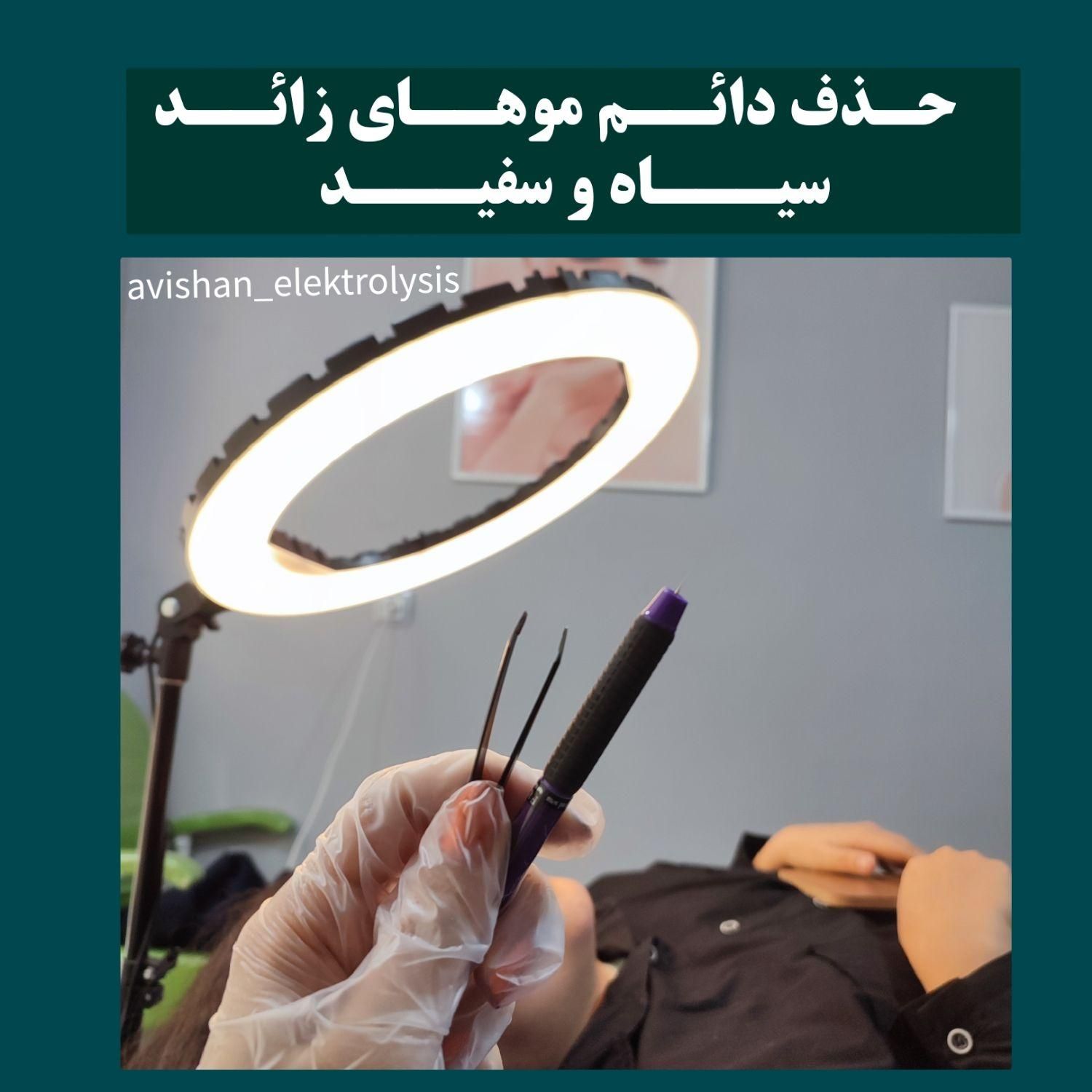 تخفیف الکترولیز،(×لیزر نیست) حذف دائم موهای زائد|خدمات آرایشگری و زیبایی|یاسوج, |دیوار