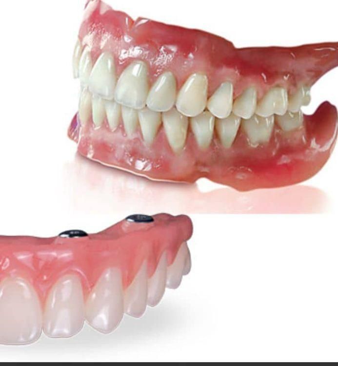 دست دندان طرح لمینیت|خدمات آرایشگری و زیبایی|تهران, مهران (سیدخندان)|دیوار
