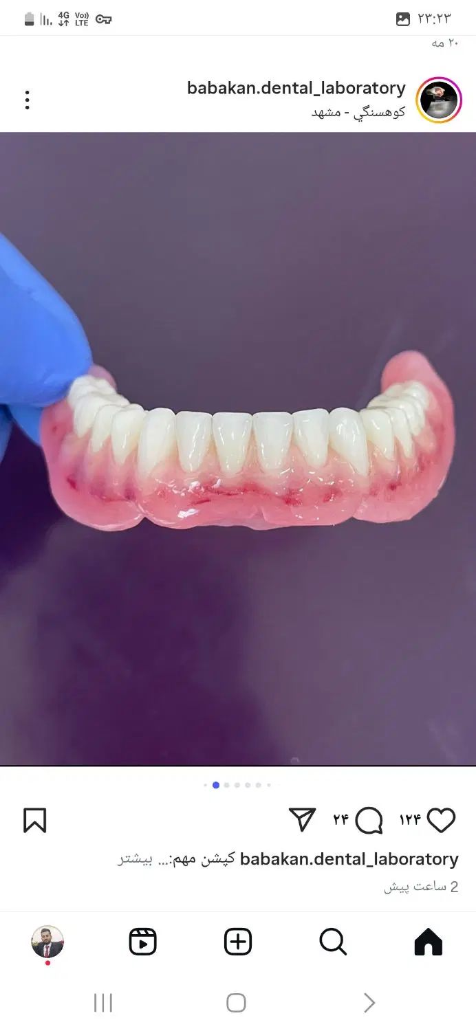 دندانسازی محمدی/طرح کامپوزیت|خدمات آرایشگری و زیبایی|محمدشهر, جعفرآباد|دیوار