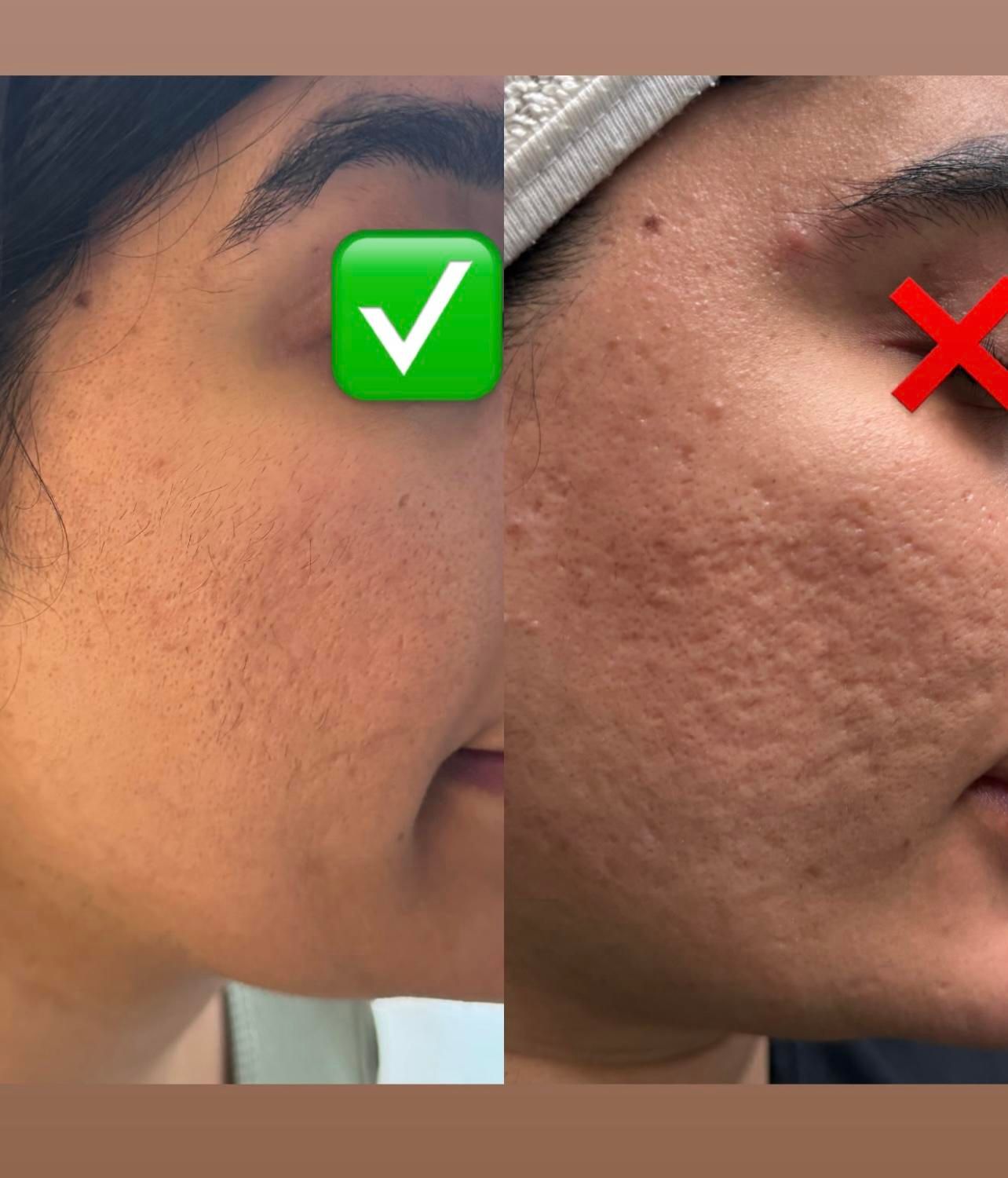 فیشال و خدمات تخصصی پوست توسط پیراپزشک در مطب پزشک|خدمات آرایشگری و زیبایی|مشهد, سجاد شهر|دیوار