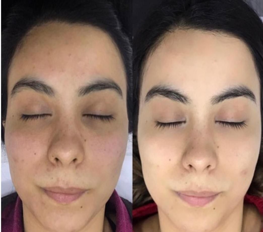 کرم سفید کننده ی عروس بندر|آرایشی، بهداشتی، درمانی|بندرعباس, |دیوار