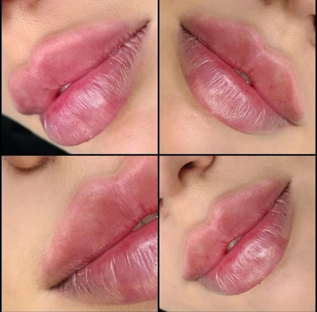 تخفیف تزریق ژل،ژل لب روسی تخصصی،بوتاکس|خدمات آرایشگری و زیبایی|اسلام‌شهر, شهرک انبیا|دیوار