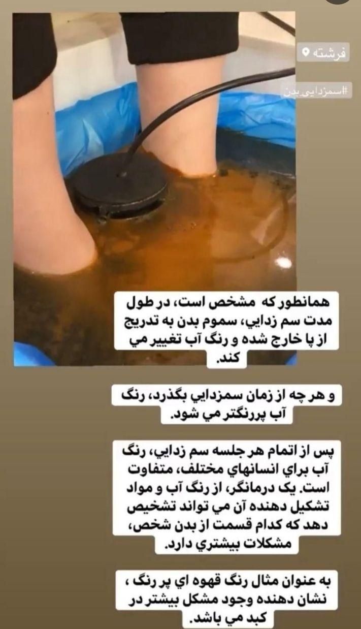 سم زدایی فیزیوتراپی حجامت و درمان کبد چرب وسیاتیک|خدمات آرایشگری و زیبایی|تبریز, |دیوار