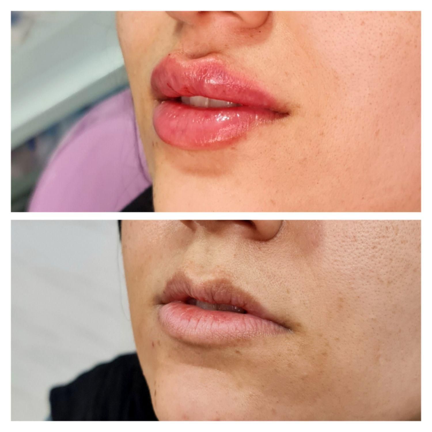 لب / ژل لب / روسی و طبیعی|خدمات آرایشگری و زیبایی|شوش, |دیوار