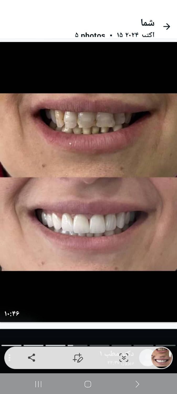 دندانپزشکی مهر با تخفیف‌های ویژه|خدمات آرایشگری و زیبایی|تهران, جنت‌آباد جنوبی|دیوار
