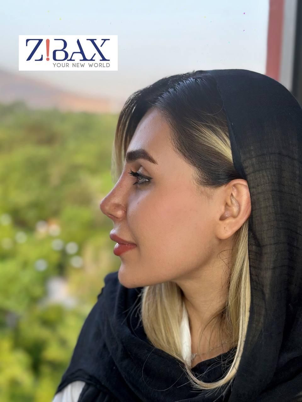 جراحی بینی در شیراز/نوبتگیری +وام+مشاوره|خدمات آرایشگری و زیبایی|جهرم, |دیوار