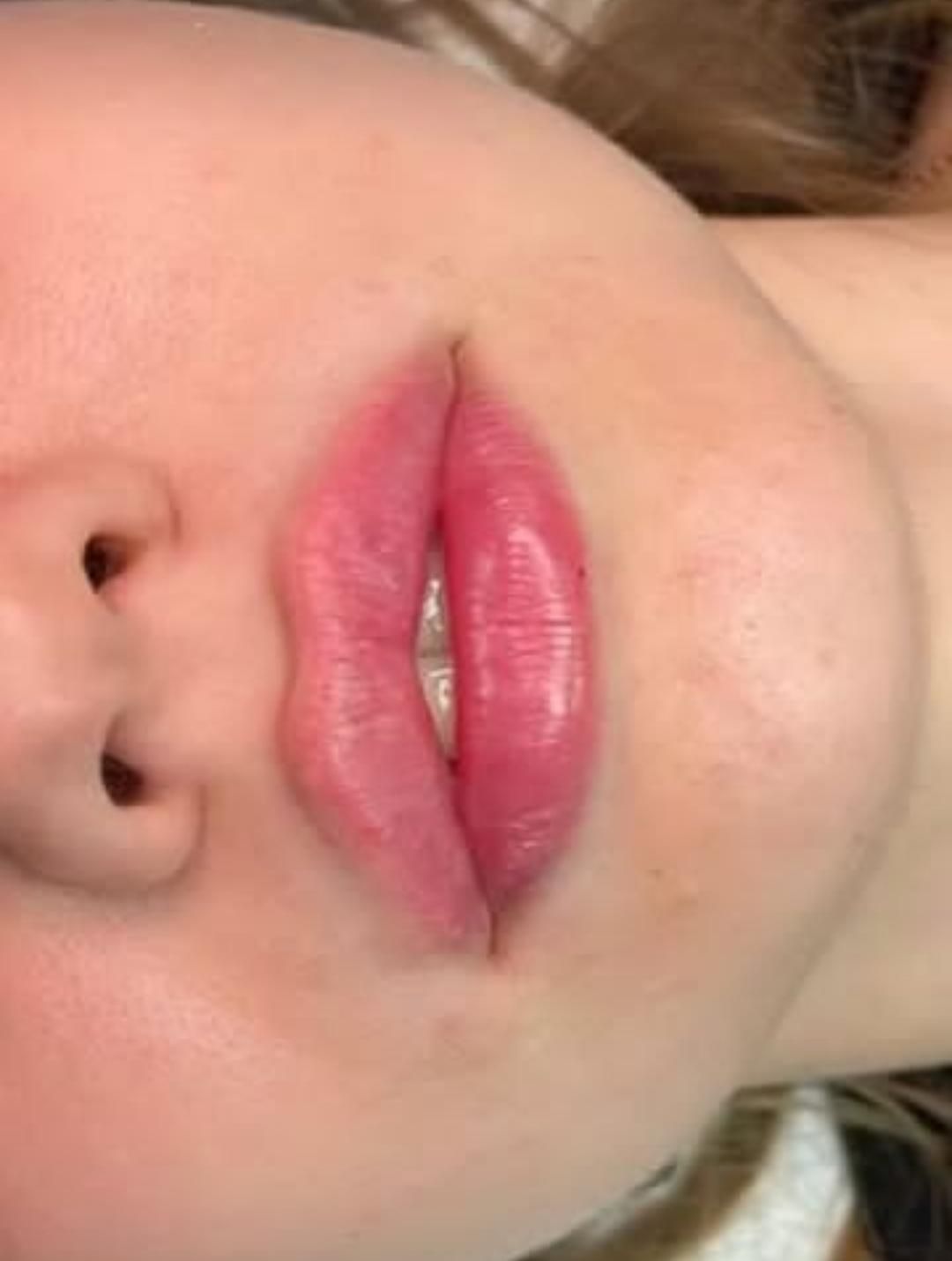 تزریق ژل و بوتاکس تمام ایام حتی روزهای تعطیل|خدمات آرایشگری و زیبایی|فردیس, |دیوار