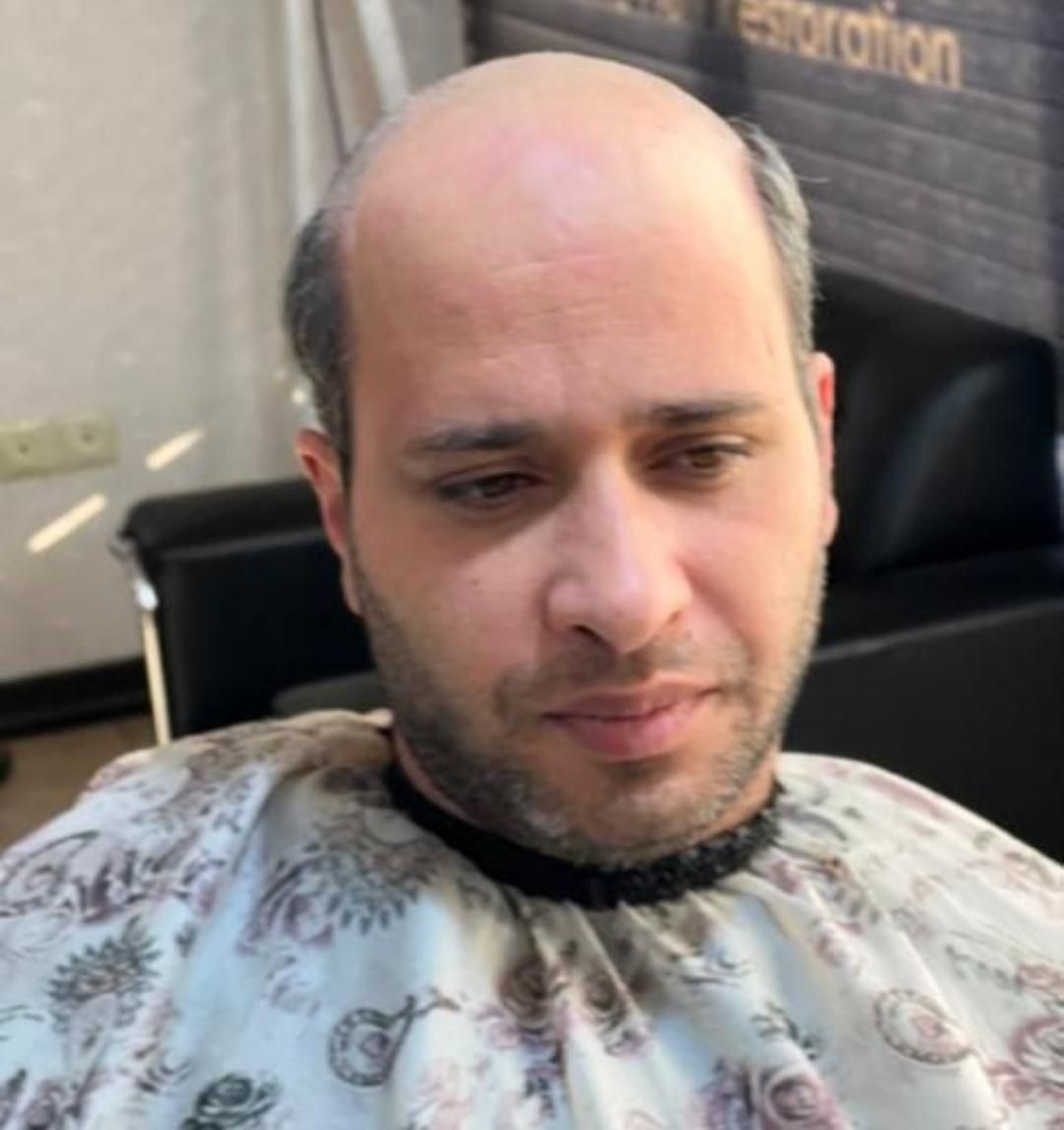 پروتز مو ، چسب پروتز ، ترمیم و تعویض چسب|خدمات آرایشگری و زیبایی|تبریز, |دیوار