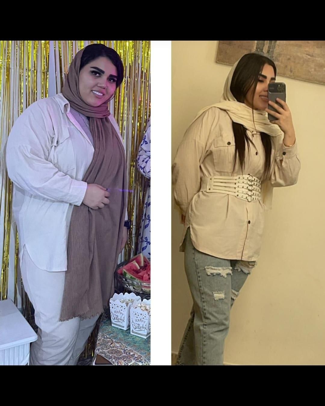 جراحی عمل اسلیومعده/اسلیو معده/چاقی لاغری/اسلیو|خدمات آرایشگری و زیبایی|تهران, چیتگر جنوبی|دیوار