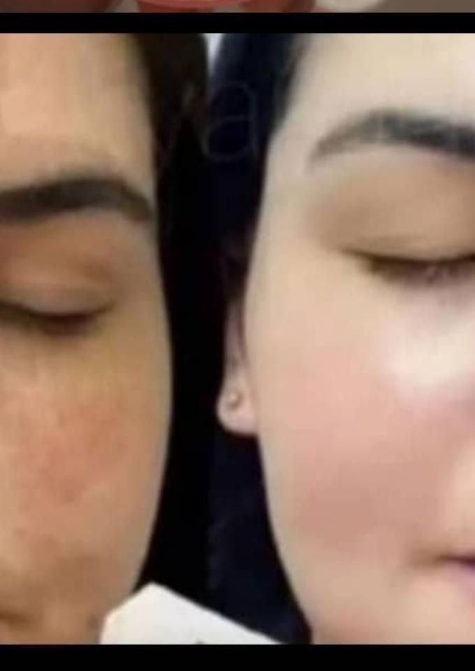 کرم معجزه چهل گیاه عربی سفید کننده ضدلک و جوش|آرایشی، بهداشتی، درمانی|شیراز, دشت چنار|دیوار
