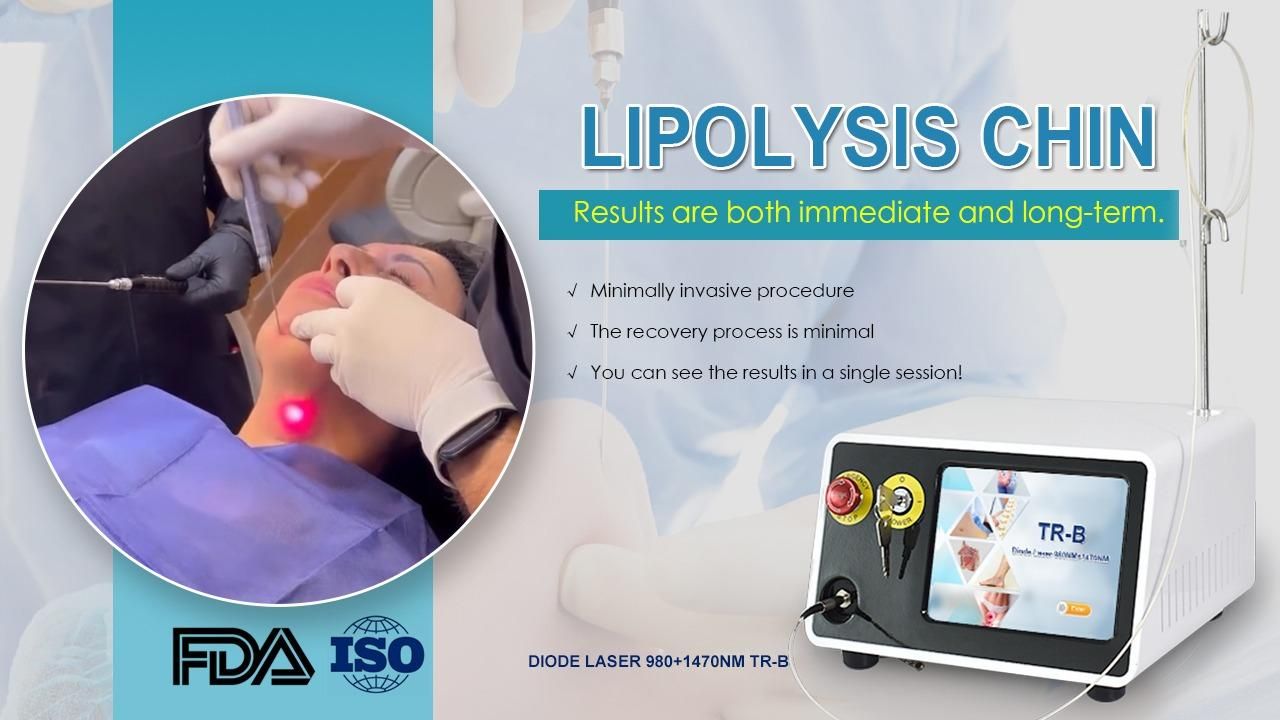 فروش دستگاه اندولیفت و اندولیزر 2024|آرایشی، بهداشتی، درمانی|دزفول, |دیوار