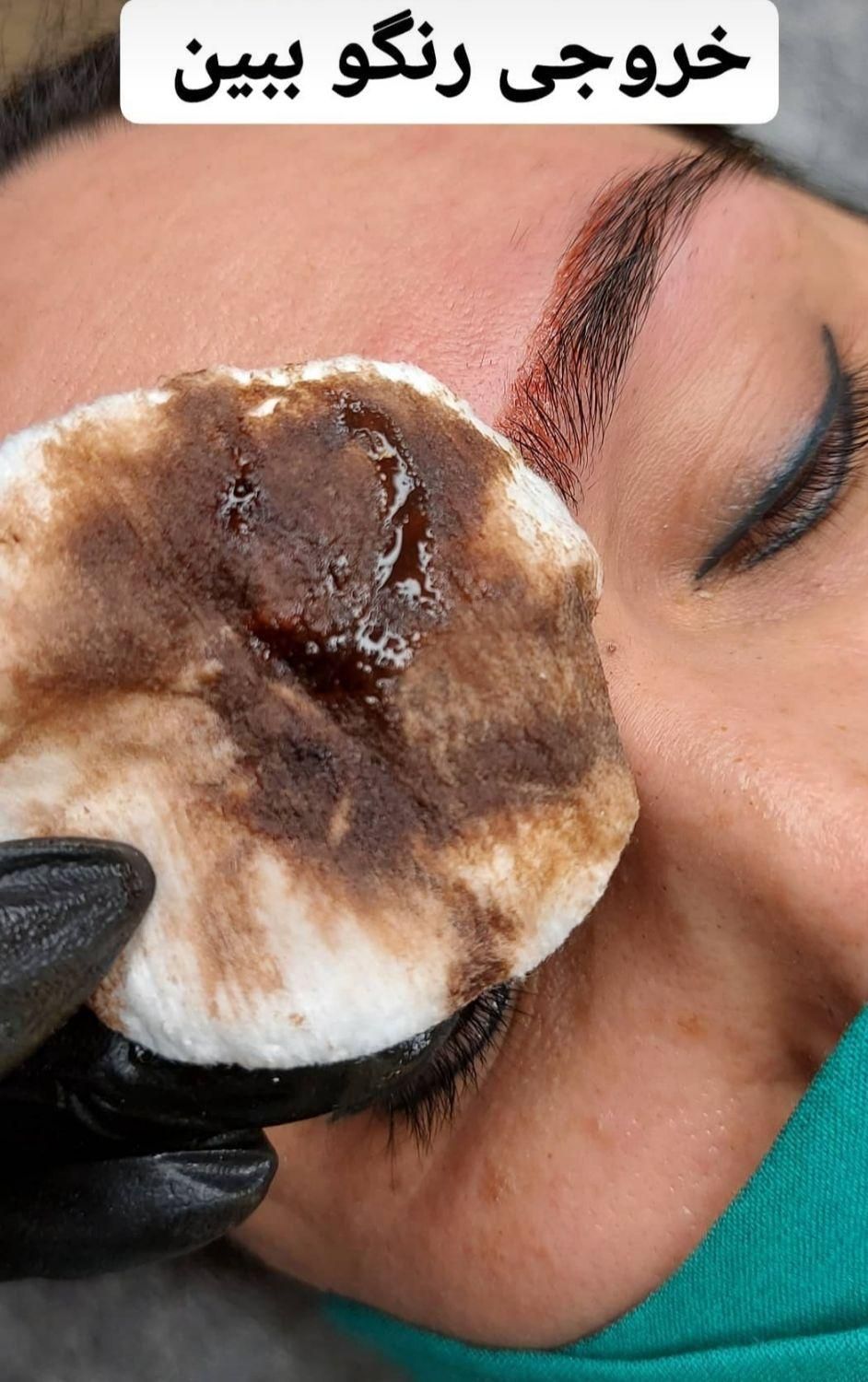 مرکز تخصصی ریمو ابرو ( پاک کردن تتو ابرو ، لب چشم|خدمات آرایشگری و زیبایی|اسلامشهر, شهرک قائمیه|دیوار